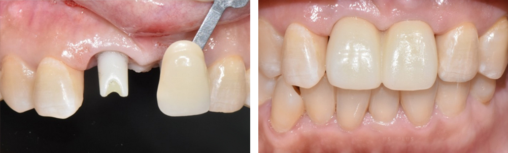 관리자 치료사례 게시판에 등록